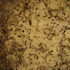 Schwarze Mückenlarven